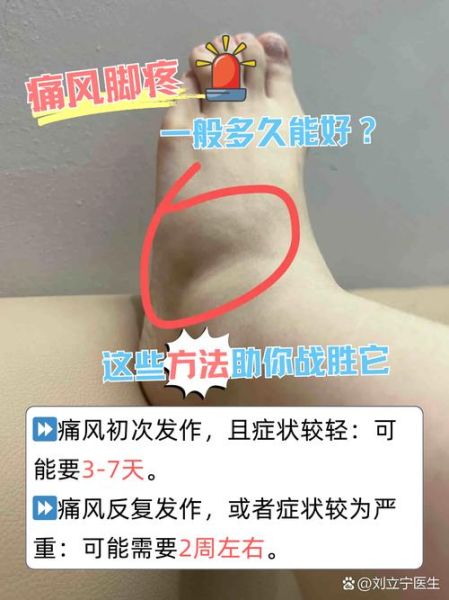 痛风能治好吗_痛风会遗传吗