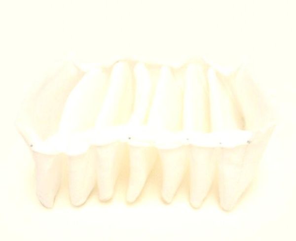 静电除尘器工作原理_静电除尘设备如何选型