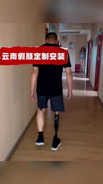 假肢价格一般多少钱_假肢使用寿命多久