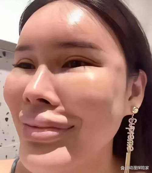 整容行业前景怎么样_整容手术安全吗