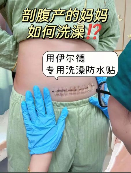 创可贴多久换一次_防水创可贴真的防水吗