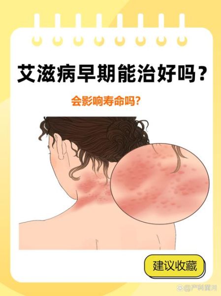 艾滋病能治好吗_艾滋病最新治疗方法有哪些