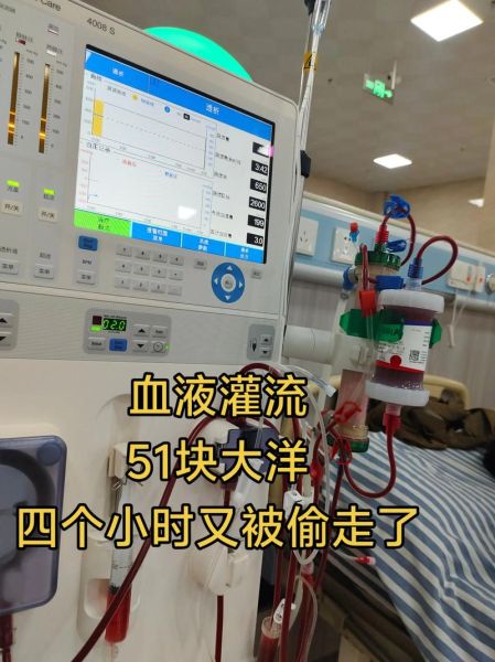 血液透析一次多少钱_血液透析能活多久