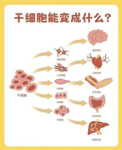 干细胞治疗安全吗_干细胞能治疗哪些疾病