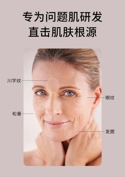 家用射频美容仪有用吗_射频美容仪多久见效