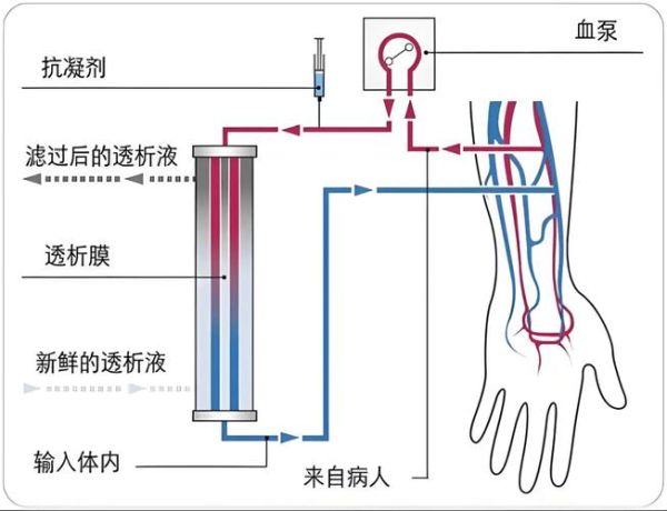 学透析前景怎么样_学透析有前途吗