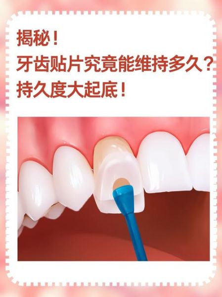 牙体修复材料有哪些_牙体缺损能自愈吗