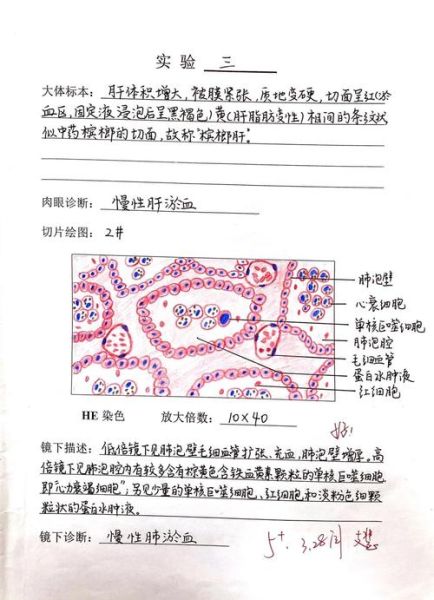 病理分析怎么做_病理报告多久能出