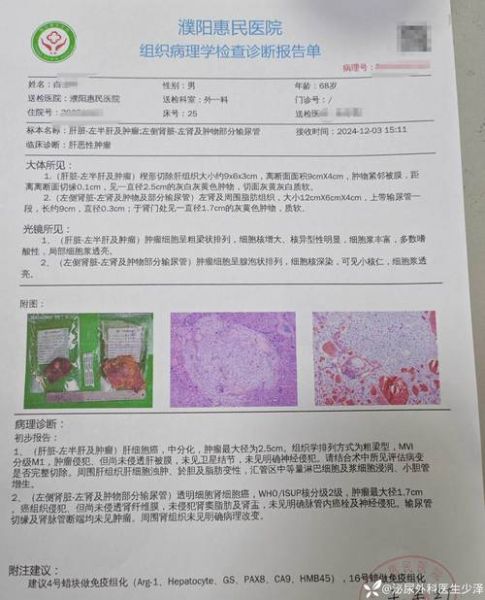 病理分析怎么做_病理报告多久能出