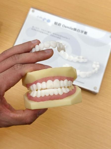 牙齿前景照能看出什么_牙齿前景照拍摄技巧