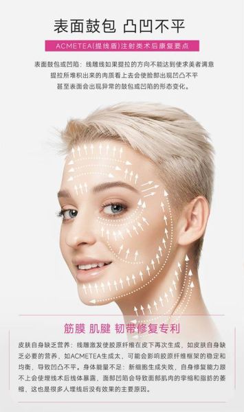 面部提升术能保持多久_面部提升术多少钱