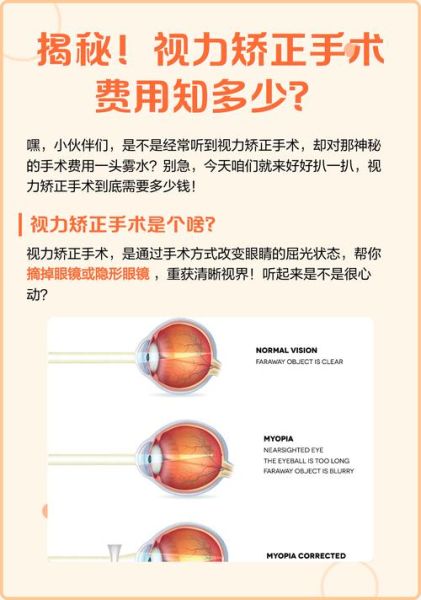 近视手术价格多少钱_视力矫正手术安全吗
