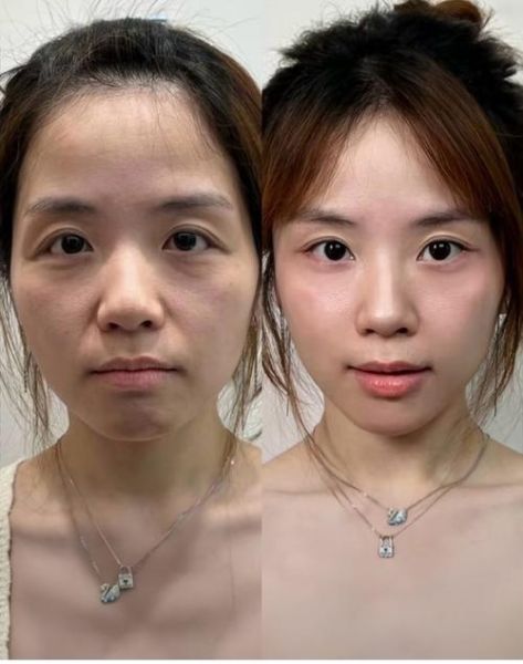 微整形市场前景怎么样_2024年还能赚钱吗