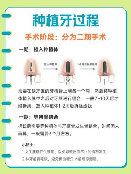 种植牙能用多久_种植牙术后注意事项