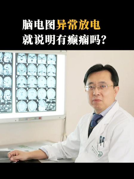 脑电图前景怎么样_脑电图能检查出什么病
